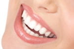 Înlocuirea și repararea smalțului dinților 1