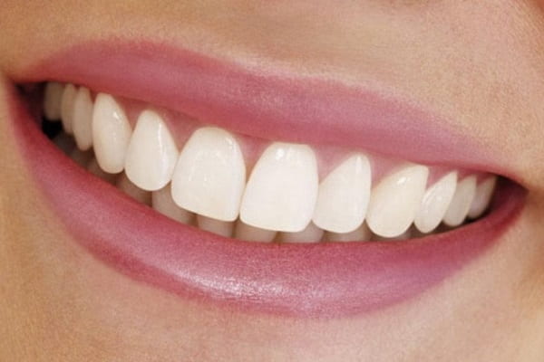 Înlocuirea și repararea smalțului dinților