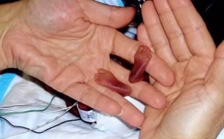 Nou-născuți - Supraviețuiri miraculoase 2