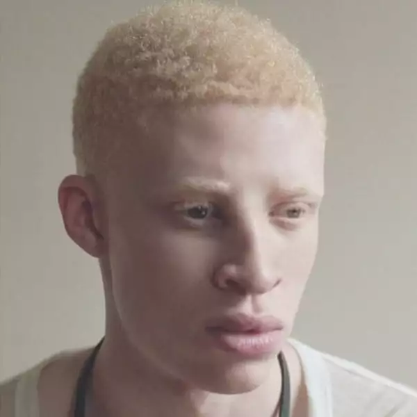 Modele ieșite din comun - Primul model masculin albinos